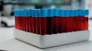 close-up-blood-samples-vacutainers-medical-tray-science-laboratory-transparent-tubes-with-red-dna-liquid-genetic-testing-glassware-flasks-coloured-bio-solution